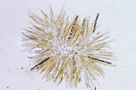 Attēlu rezultāti vaicājumam “Hypocrea gelatinosa”