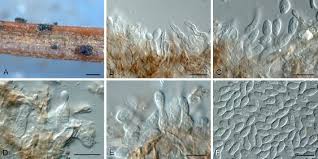 Attēlu rezultāti vaicājumam “Ombrophila violacea spores”