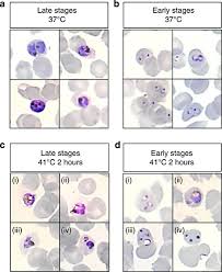 Attēlu rezultāti vaicājumam “undetermined plasmodium”