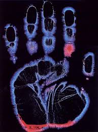 Image result for Jakub Jodko-Narkiewicz Kirlian