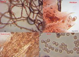 Attēlu rezultāti vaicājumam “Arcyria incarnata spores”