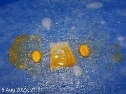 Attēlu rezultāti vaicājumam “Badhamia sp.”