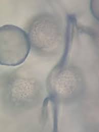 Attēlu rezultāti vaicājumam “Comatricha ellae spores”