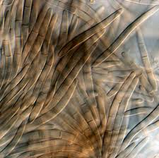 Attēlu rezultāti vaicājumam “Mycosphaerella millegrana”