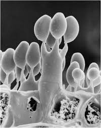 Attēlu rezultāti vaicājumam “Diderma globosum spores”