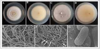Attēlu rezultāti vaicājumam “Stemonitopsis aequalis var. microspora stalked”