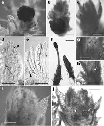 Attēlu rezultāti vaicājumam “Cephalozia bicuspidata sporophyte”