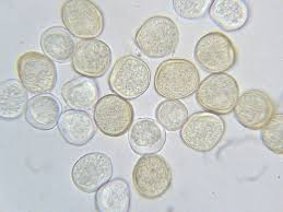 Attēlu rezultāti vaicājumam “Tranzschelia pruni-spinosae”