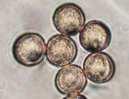 Attēlu rezultāti vaicājumam “Stemonitis pallida var. rubescens”