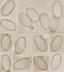 Attēlu rezultāti vaicājumam “Peziza flavida”