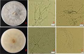Attēlu rezultāti vaicājumam “Trichia botrytis var. cerifera spores”
