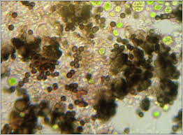 Attēlu rezultāti vaicājumam “Xanthoriicola physciae”