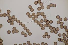 Attēlu rezultāti vaicājumam “Craterium aureonucleatum spores”