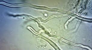 Attēlu rezultāti vaicājumam “Antrodiella serpula”