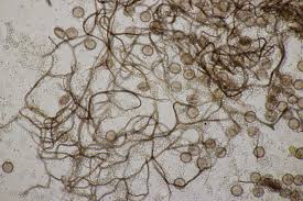 Attēlu rezultāti vaicājumam “Diachea leucopodia”