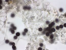 Attēlu rezultāti vaicājumam “Trichia contorta spores”