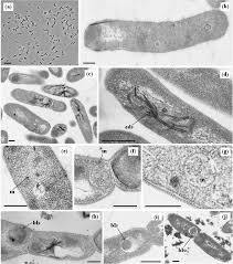Attēlu rezultāti vaicājumam “Diderma subviridifuscum macro”