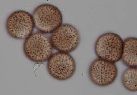 Attēlu rezultāti vaicājumam “Diderma effusum spores”