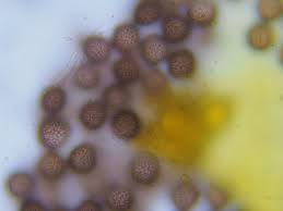 Attēlu rezultāti vaicājumam “Physarum viride var. aurantium spores”