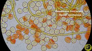 Attēlu rezultāti vaicājumam “Hemitrichia leiotricha”
