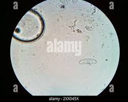 Attēlu rezultāti vaicājumam “Propolis farinosa”