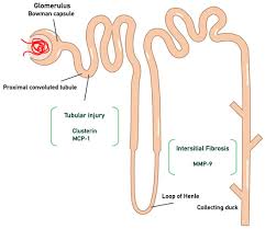 Image result for Yeo Bowmen