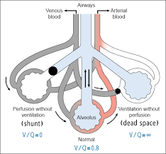 Image result for  v    q