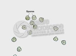 Attēlu rezultāti vaicājumam “Licea minima spores”