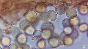 Attēlu rezultāti vaicājumam “Lindbladia tubulina spores”