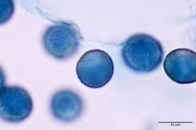 Attēlu rezultāti vaicājumam “Diderma cinereum spores”