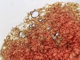 Attēlu rezultāti vaicājumam “Hemitrichia chrysospora sessile”