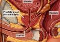 Dyspareunia - treatment of Dyspareunia , types Diseases, Index A ...