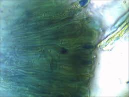 Attēlu rezultāti vaicājumam “Biatora sphaeroides”