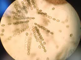 Attēlu rezultāti vaicājumam “Ascomycota”