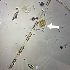 Attēlu rezultāti vaicājumam “Nostoc pruniforme macro”