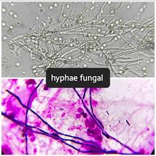 Attēlu rezultāti vaicājumam “Sanionia uncinata  sporophyte”