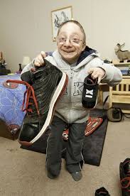 Image result for Nanismo Primordial