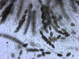 Attēlu rezultāti vaicājumam “Diderma simplex macro”