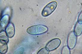 Attēlu rezultāti vaicājumam “Nectria peziza”