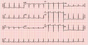 Image result for  ^ L V [ h    