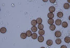 Attēlu rezultāti vaicājumam “Fuligo septica var. flava young”