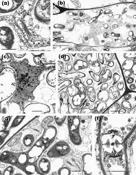 Attēlu rezultāti vaicājumam “Harpanthus flotovianus cells”