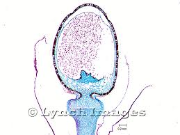 Attēlu rezultāti vaicājumam “Sphagnum sporophyte”