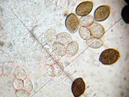 Attēlu rezultāti vaicājumam “Melanospora lagenaria”