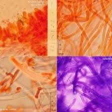 Attēlu rezultāti vaicājumam “Postia tephroleucus”