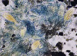 Attēlu rezultāti vaicājumam “Opegrapha atra”