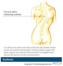 Image result for Curves