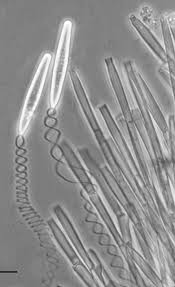 Attēlu rezultāti vaicājumam “Ophiostoma polyporicola”