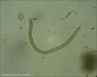 Attēlu rezultāti vaicājumam “Oligonema favogineum spores”