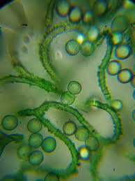 Attēlu rezultāti vaicājumam “Arcyria globosa spores”